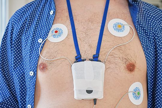 24 Stunden Blutdruckmessung und EKG